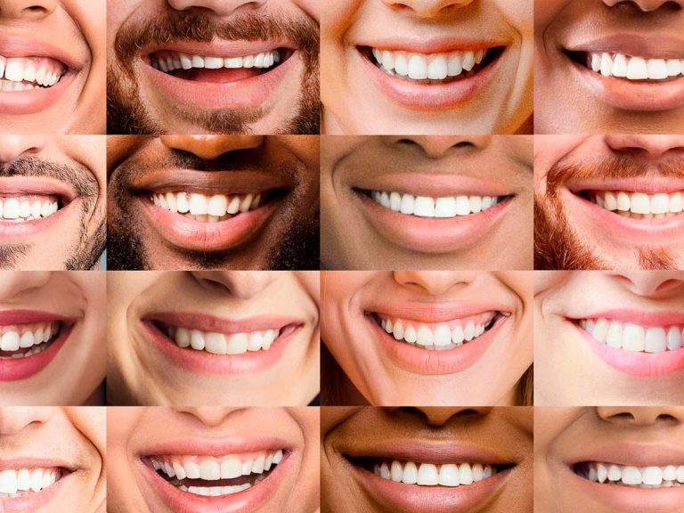 sorriso